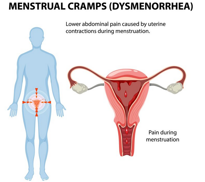 ما هي أسباب تقلصات الدورة الشهرية؟